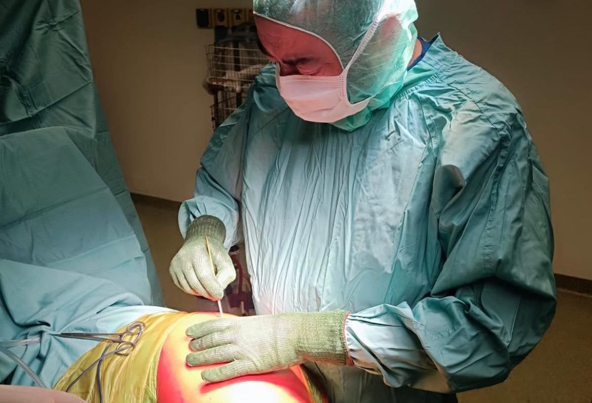 operazione